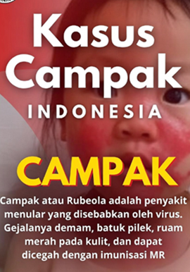 Kasus Campak Indonesia